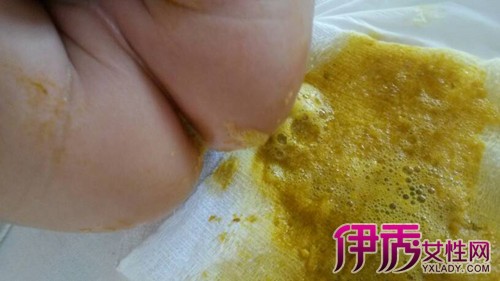 宝宝五个月拉肚子怎么办